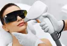 what is considered a small area for laser hair removal